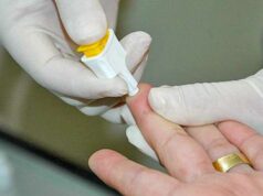 Servidora da Saúde ministra webpalestra sobre hepatites virais