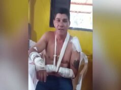 Motociclista que diz ter sido atacado por onça atropelou jaguatirica