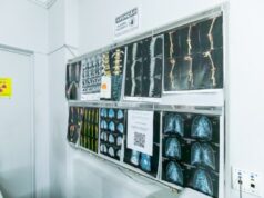 Saúde de Cuiabá já oferece mamografia e ressonância para mulheres