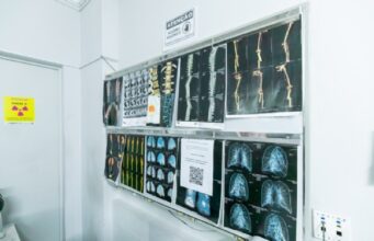 Saúde de Cuiabá já oferece mamografia e ressonância para mulheres