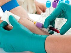 Ação preventiva leva exames e orientação sobre micose endêmica às comunidades rurais – Ação preventiva leva exames e orientação sobre micose endêmica às comunidades rurais