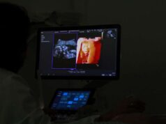 Ultrassom Morfológico garante acompanhamento detalhado da gestação e do bebê em Várzea Grande